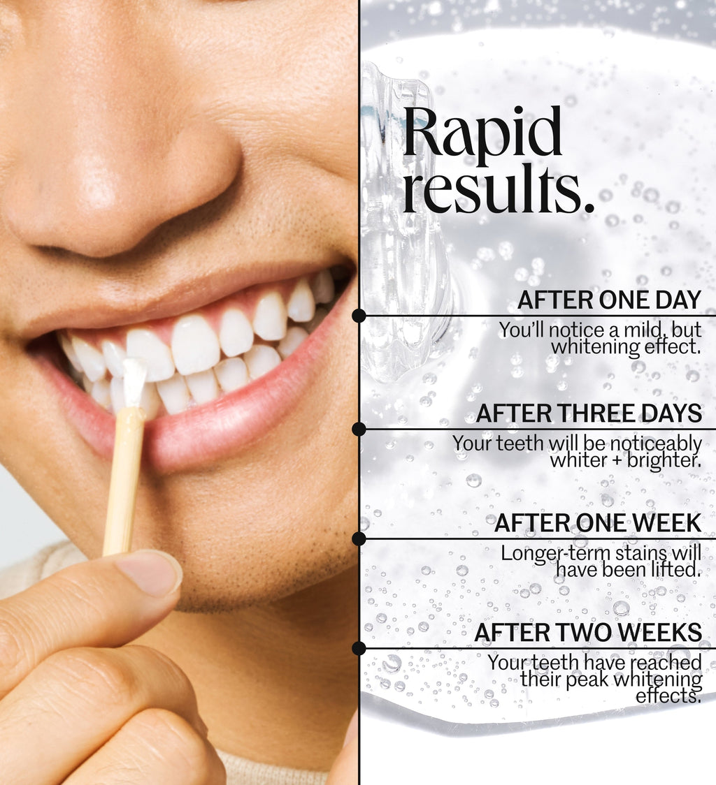 The Everyday Whitening System