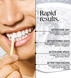 The Everyday Whitening System