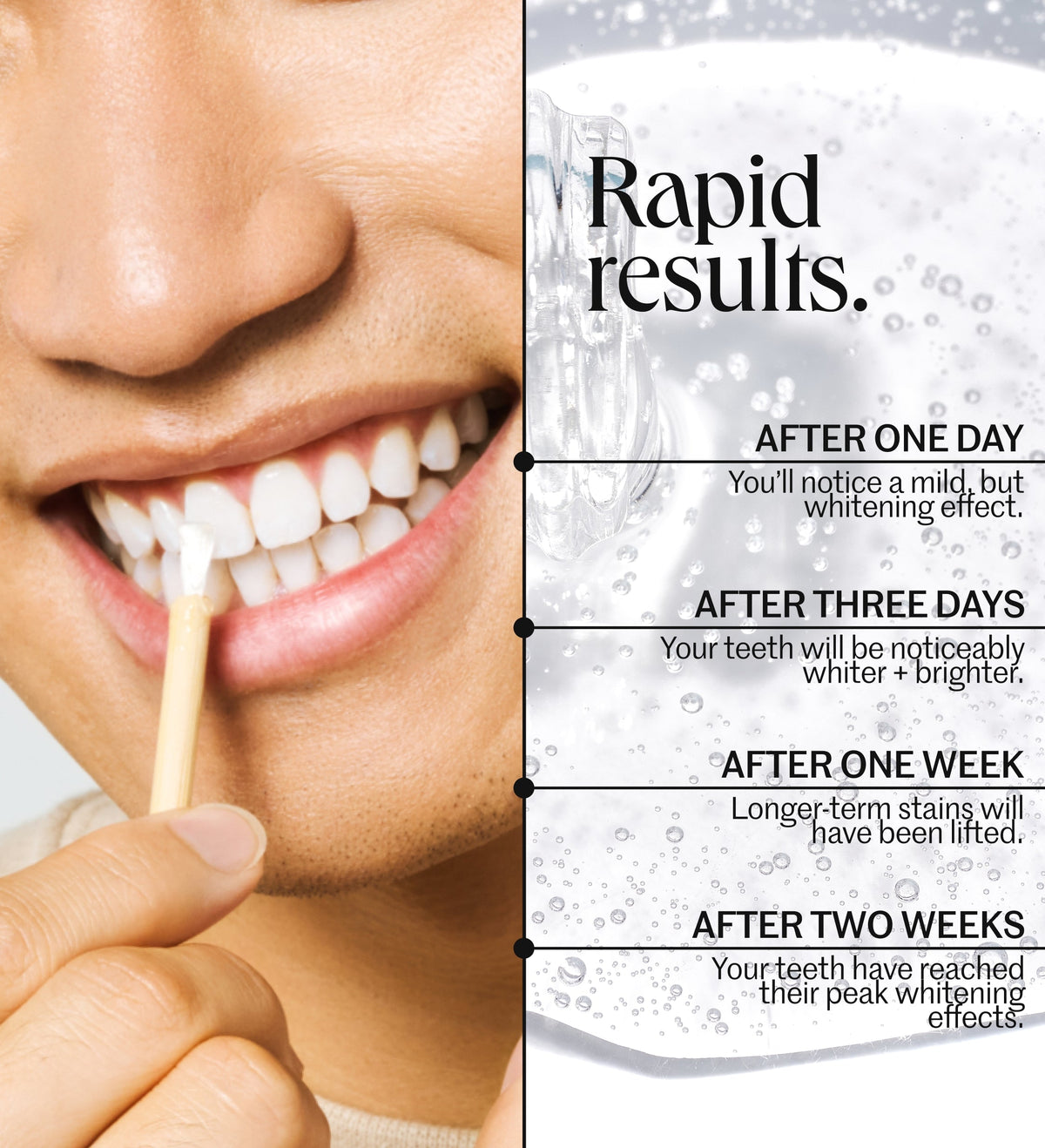 The Everyday Whitening System